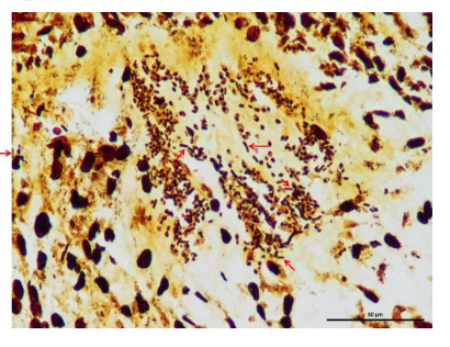 Warthin-Starry銀染-江蘇網(wǎng)站制作