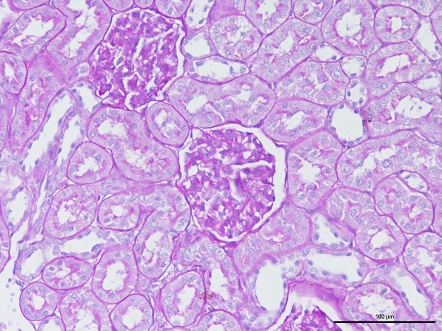病理染色-PAS-江蘇網(wǎng)站制作