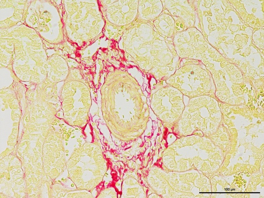 病理染色-天狼星紅染色-江蘇網(wǎng)站制作