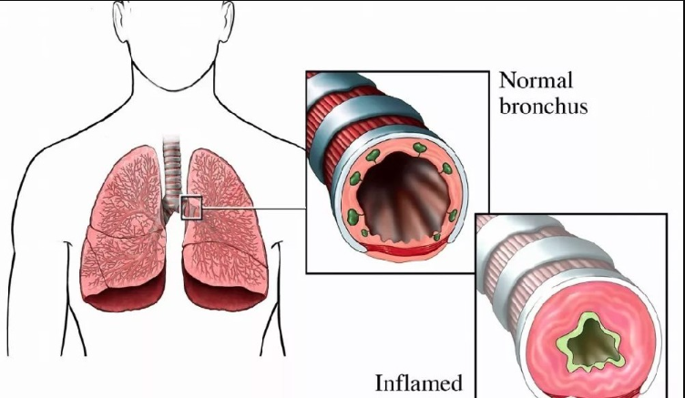 大鼠慢性支氣管炎造模SOP