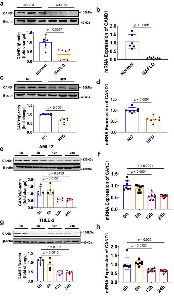調(diào)控NAFLD疾病進(jìn)程