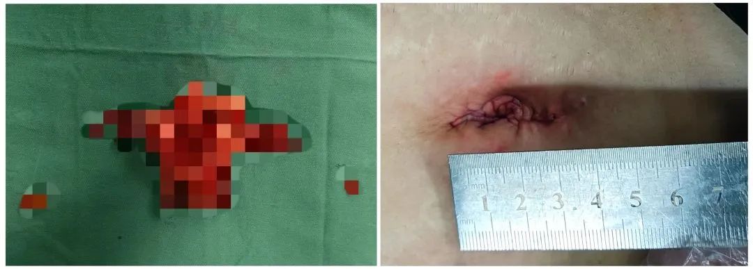 20230322445249.jpg 20230322445249.jpg