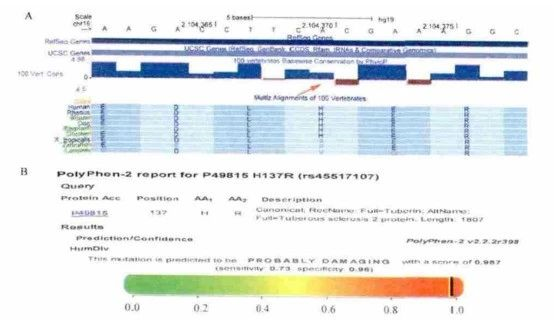 結(jié)節(jié)性硬化癥