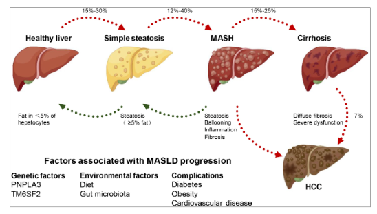 代謝功能障礙相關(guān)性脂肪肝（MASLD）小核酸療法研究模型-江蘇網(wǎng)站制作