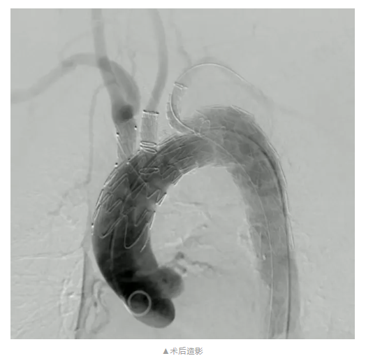 【伙伴喜訊】心脈醫(yī)療?Hector?胸主多分支支架獲歐盟定制證書-江蘇網(wǎng)站制作