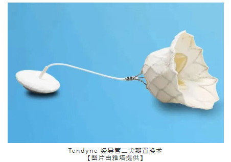 【海外風(fēng)雲(yún)】雅培報(bào)告美國(guó)首個(gè)商業(yè)化 Tendyne 二尖瓣植入物-江蘇網(wǎng)站制作